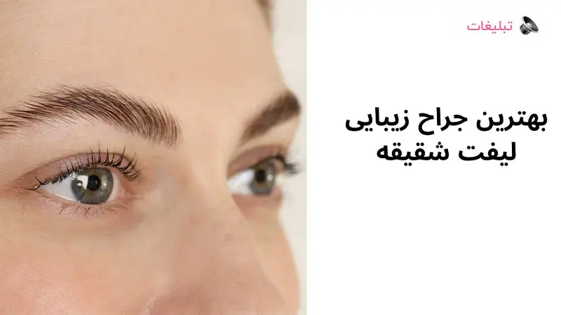 بهترین جراح زیبایی لیفت شقیقه